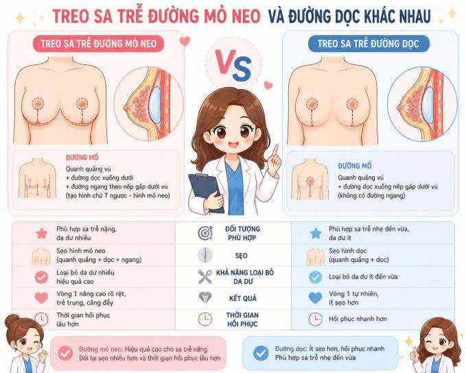 treo-sa-tre-duong-mo-neo-va-duong-doc-khac-nhau-nhu-the-nao-giai-phap-nao-phu-hop-cho-tung-tinh-trang