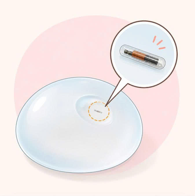 nang-nguc-nano-chip-ergonomix-la-loai-tui-gi-giai-dap-chi-tiet-cac-thong-tin-tu-a-z-truoc-khi-lua-chon