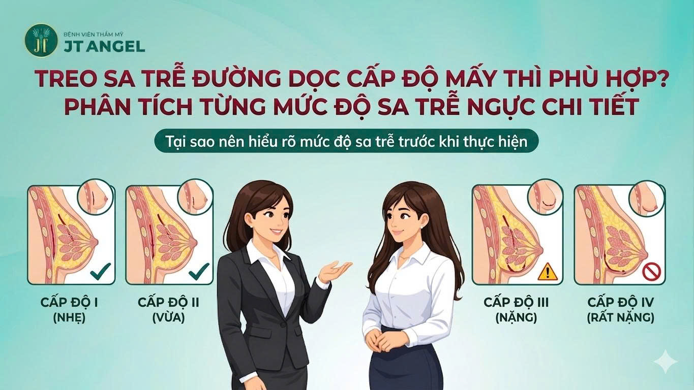treo-sa-tre-duong-doc-cap-do-may-thi-phu-hop-phan-tich-tung-muc-do-sa-tre-nguc-chi-tiet