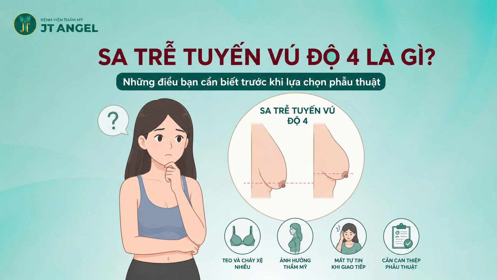 sa-tre-tuyen-vu-do-4-la-gi-nhung-dieu-ban-can-biet-truoc-khi-lua-chon-phau-thuat