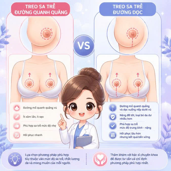 so-sanh-treo-sa-tre-duong-quang-va-duong-doc-uu-diem-quy-trinh-thuc-hien-va-nhung-dieu-can-biet-truoc-khi-lua-chon-phuong-phap-thuc-hien
