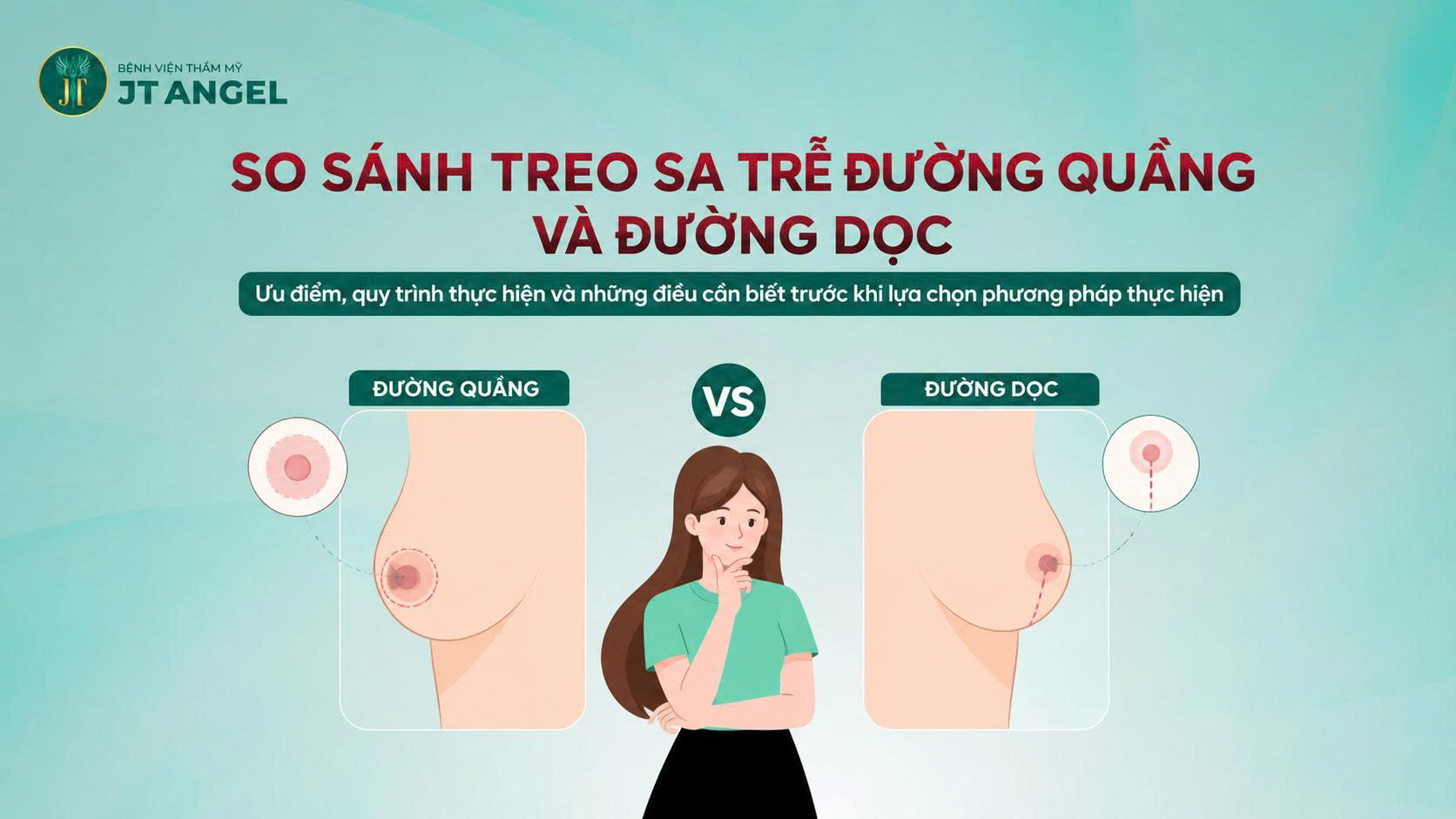 so-sanh-treo-sa-tre-duong-quang-va-duong-doc-uu-diem-quy-trinh-thuc-hien-va-nhung-dieu-can-biet-truoc-khi-lua-chon-phuong-phap-thuc-hien