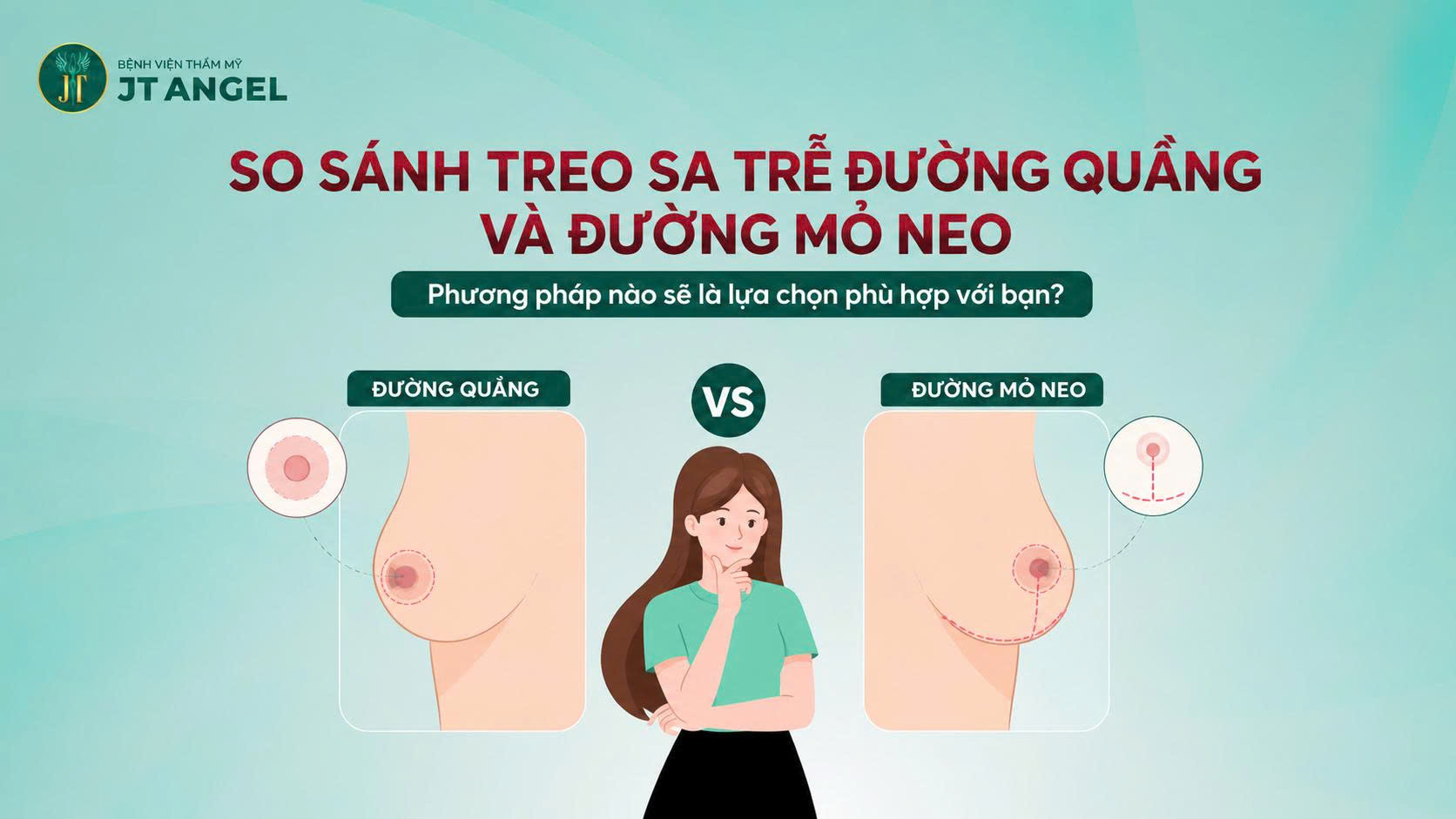 so-sanh-treo-sa-tre-duong-quang-va-duong-mo-neo-phuong-phap-nao-se-la-lua-chon-phu-hop-voi-ban