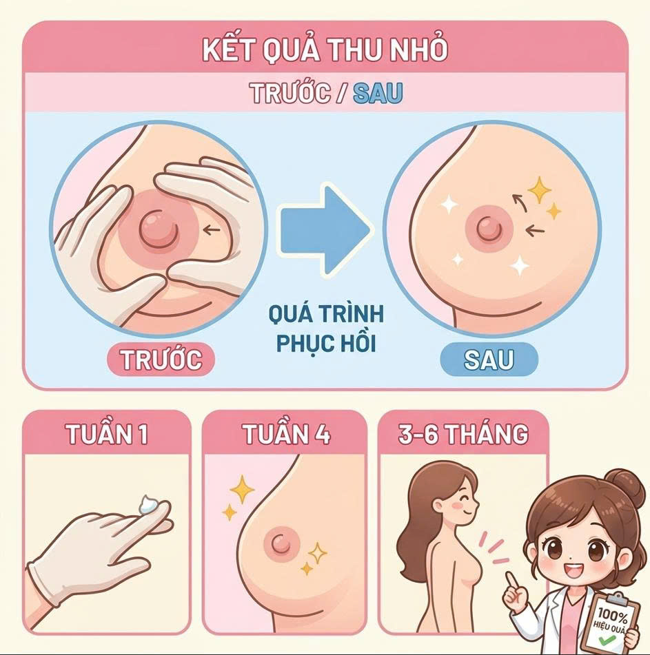 dau-nhu-hoa-dai-sau-sinh-do-dau-co-nen-thuc-hien-phuong-phap-thu-nho-de-cai-thien-hinh-dang-khong